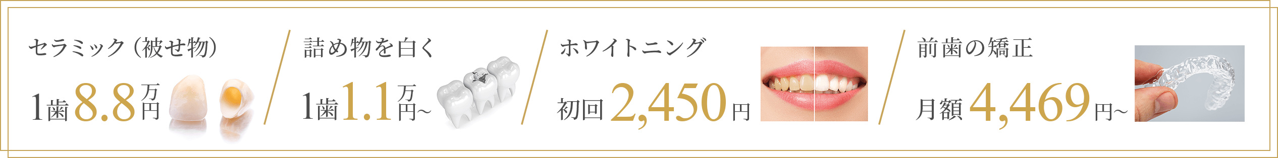 セラミック(被せ物) 1歯8.8万円|詰め物を白く 1歯1.1万円~|ホワイトニング 初回2,450円|前歯の矯正 月額4,469円~